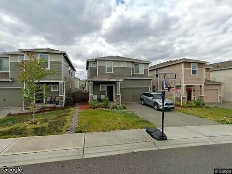 Lipoma, PUYALLUP, WA 98374